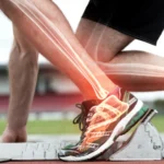 BPC-157 And Bone Healing: Understanding Potential Recovery Support